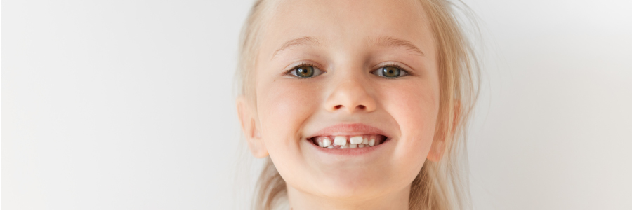 3 conseils pour éviter le recours à l'orthodontie dentiste bagneux