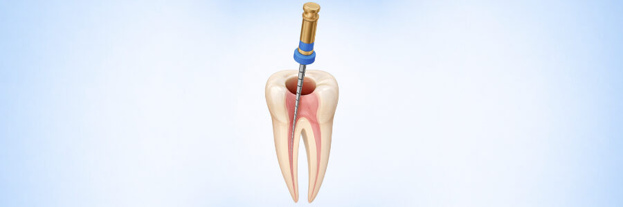 dents-de-lait-dentiste-enfant-bagneux.pdf
