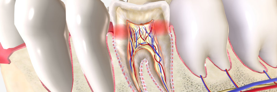 dentiste bagneux
